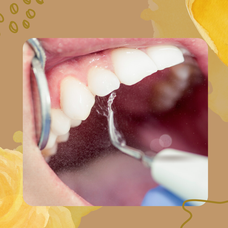 Teeth Cleanings and Other Therapies