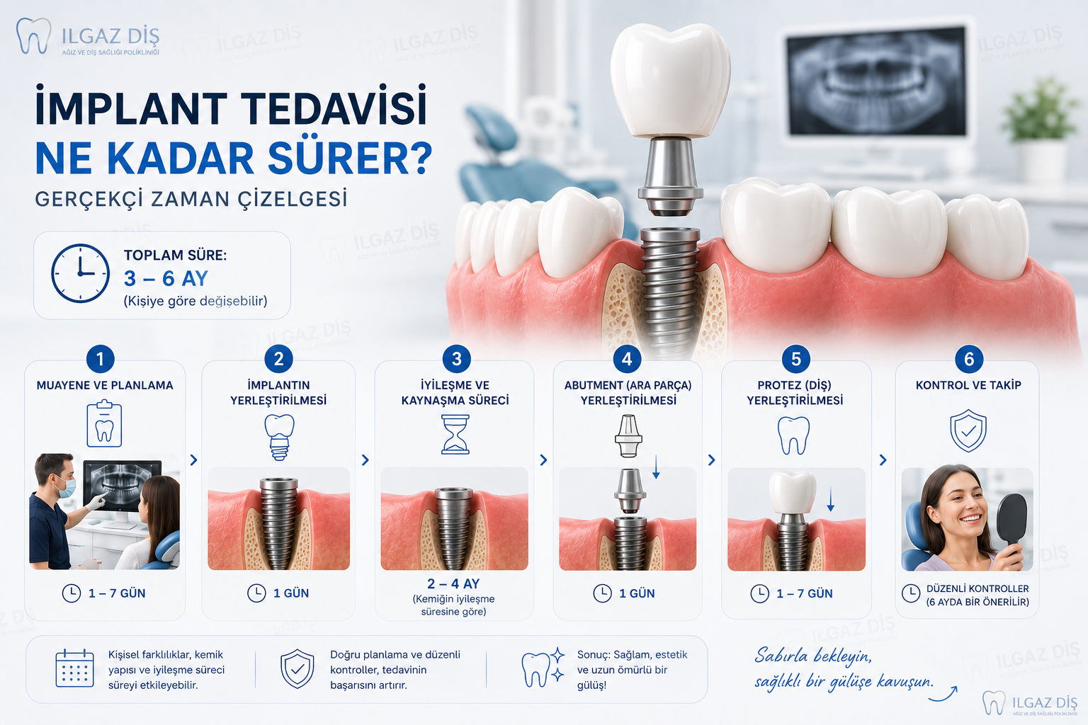 İmplant Tedavisi Ne Kadar Sürer? Gerçekçi Zaman Çizelgesi