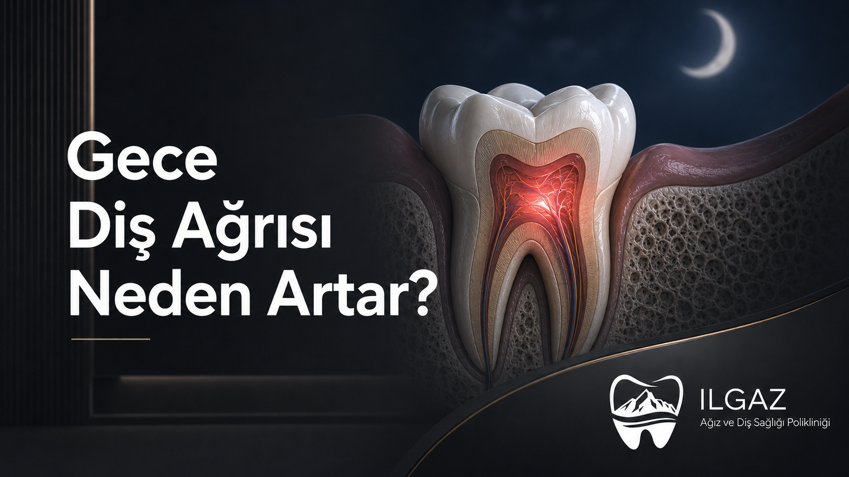 Gece Diş Ağrısı Neden Artar? Evde Ne Yapılmalı?