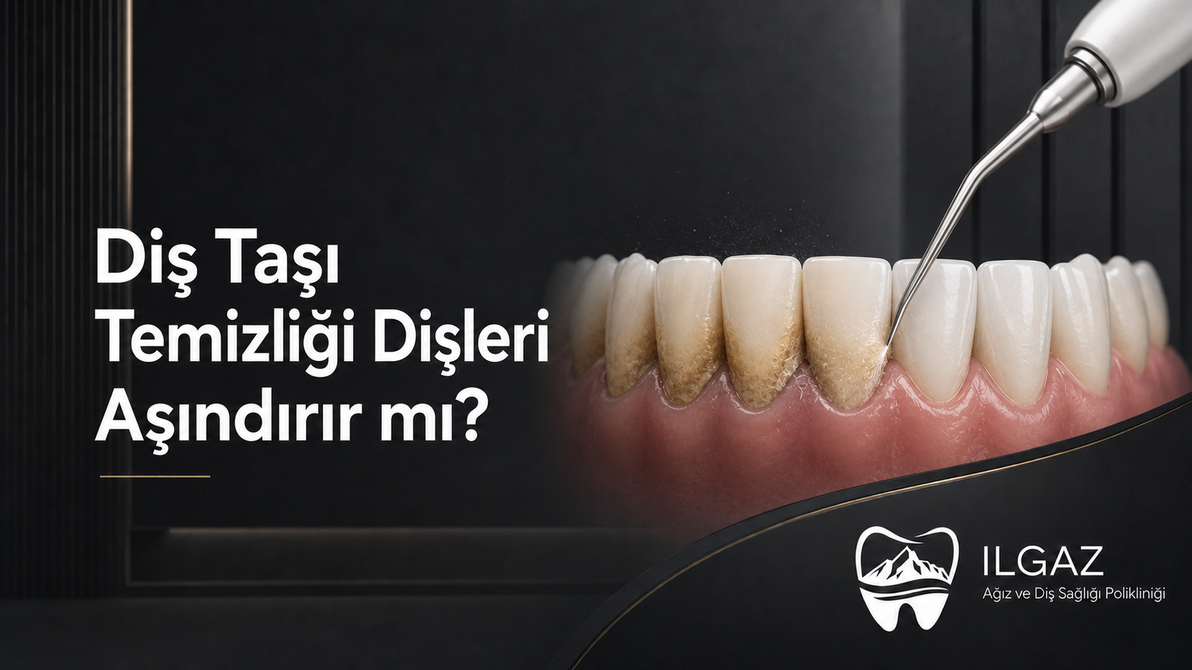 Diş Taşı Temizliği Dişleri Aşındırır mı? En Yaygın 8 Yanlış