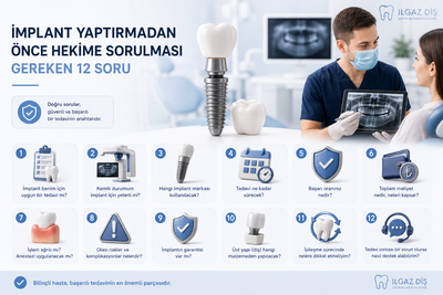 İmplant Yaptırmadan Önce Hekime Sorulması Gereken 12 Soru