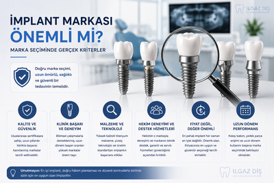 İmplant Markası Önemli mi? Marka Seçiminde Gerçek Kriterler