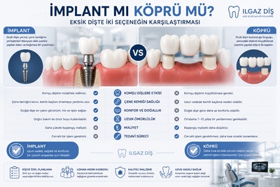 İmplant mı Köprü mü? Eksik Dişte İki Seçeneğin Karşılaştırması
