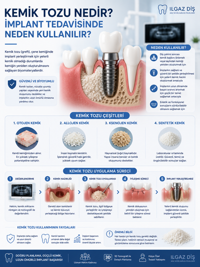 Kemik Tozu Nedir? İmplant Tedavisinde Neden Kullanılır?