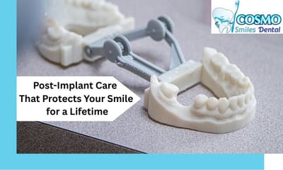 Best Aftercare Tips for Dental Implants: Arlington Dentists Recommend These