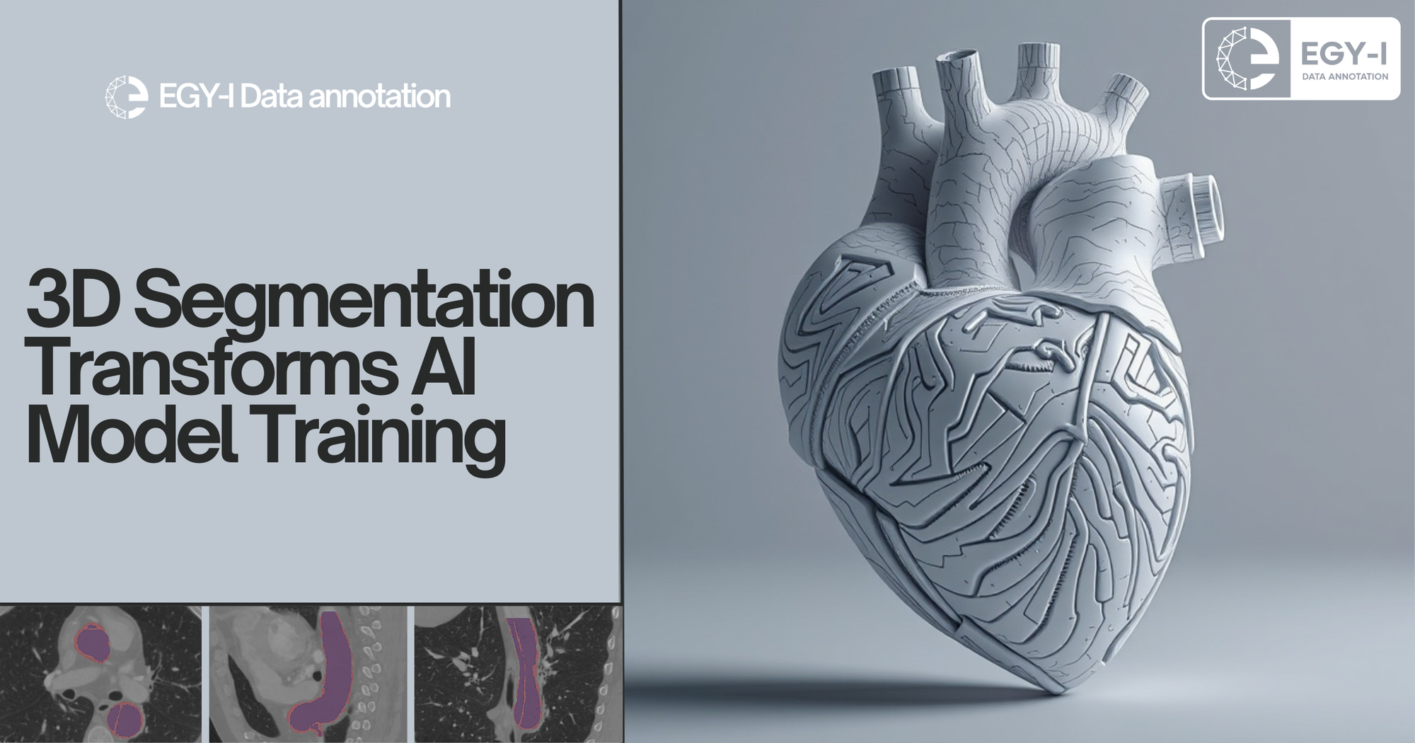 How 3D Segmentation Transforms AI Model Training for Heart Disease