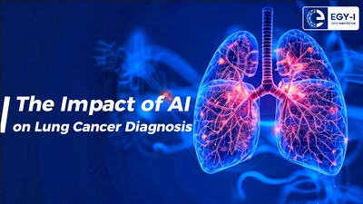 Revolutionizing Early Detection: The Impact of Artificial Intelligence on Lung Cancer Diagnosis