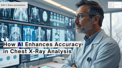 How AI Enhances Accuracy in Chest X-Ray Analysis