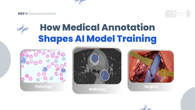 The Critical Role of Medical Annotation in AI Model Training