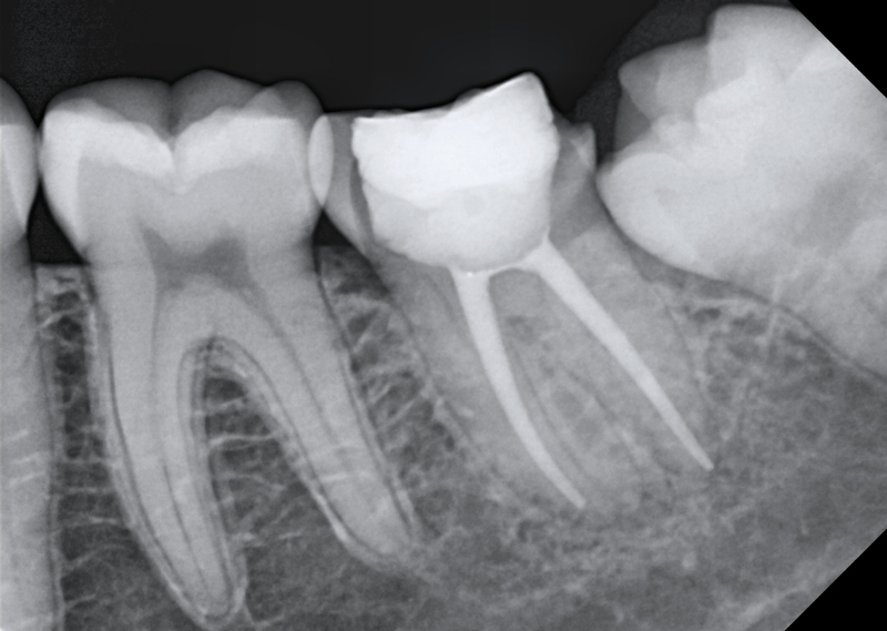 Dental x-ray