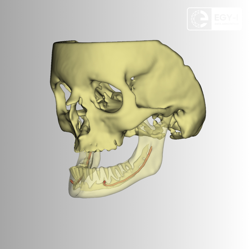 3D segmentation