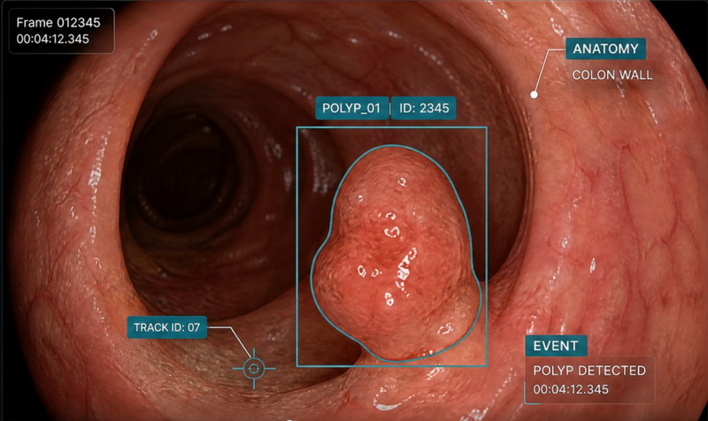Gastrointrology