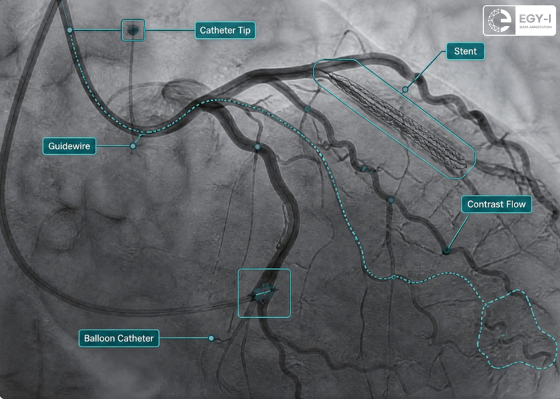 Cardiology