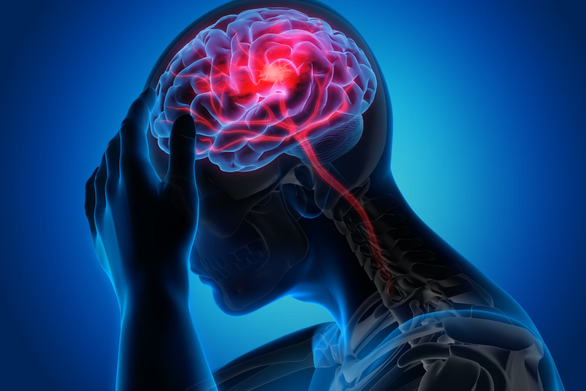 Identifying the signs of Stroke