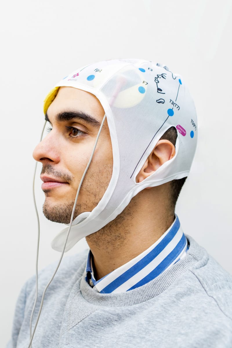 tDCS