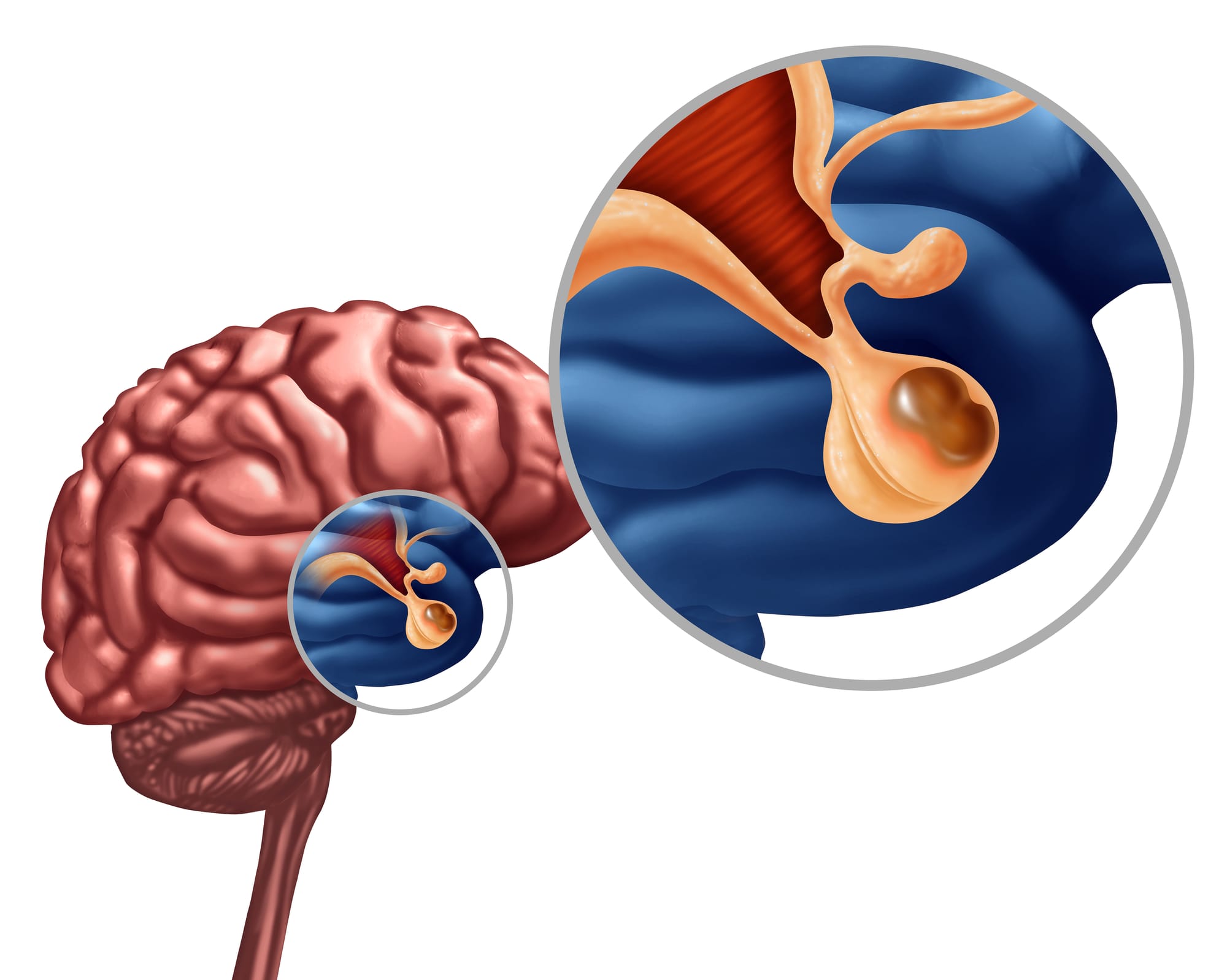 Salud Sexual en personas con Adenomas Hipofisarios