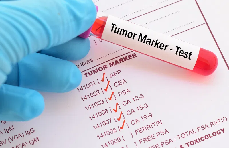 تحاليل دلالات الأورام من الدم في الكويت: لماذا يُعد مختبر الطائي الخيار الأفضل؟