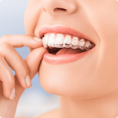 Redefine Your Look with Expert Cosmetic Dentistry in Dubai