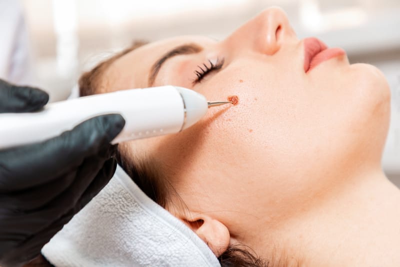 Fisioterapia Dermatofuncional