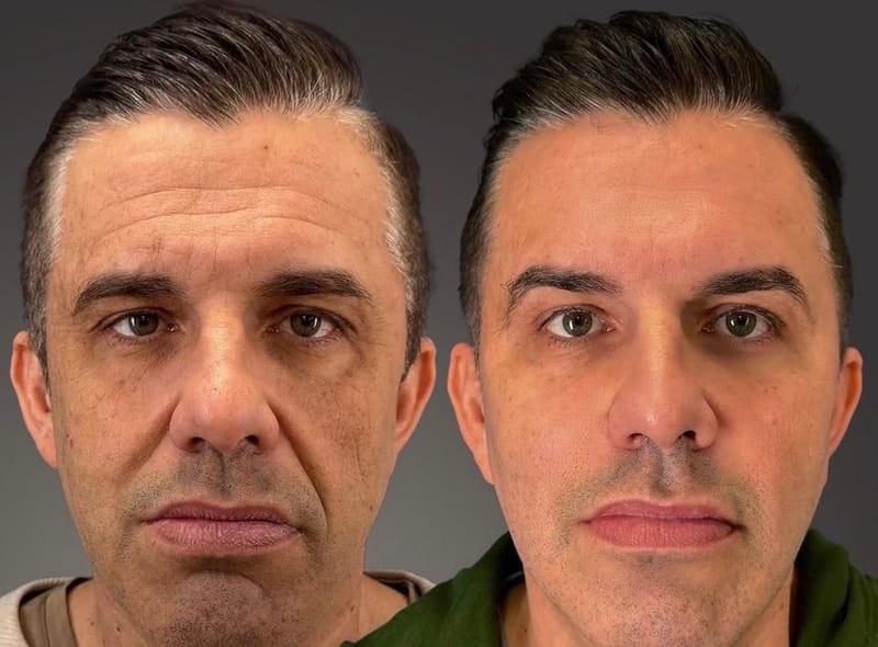 תוצאות גברים
