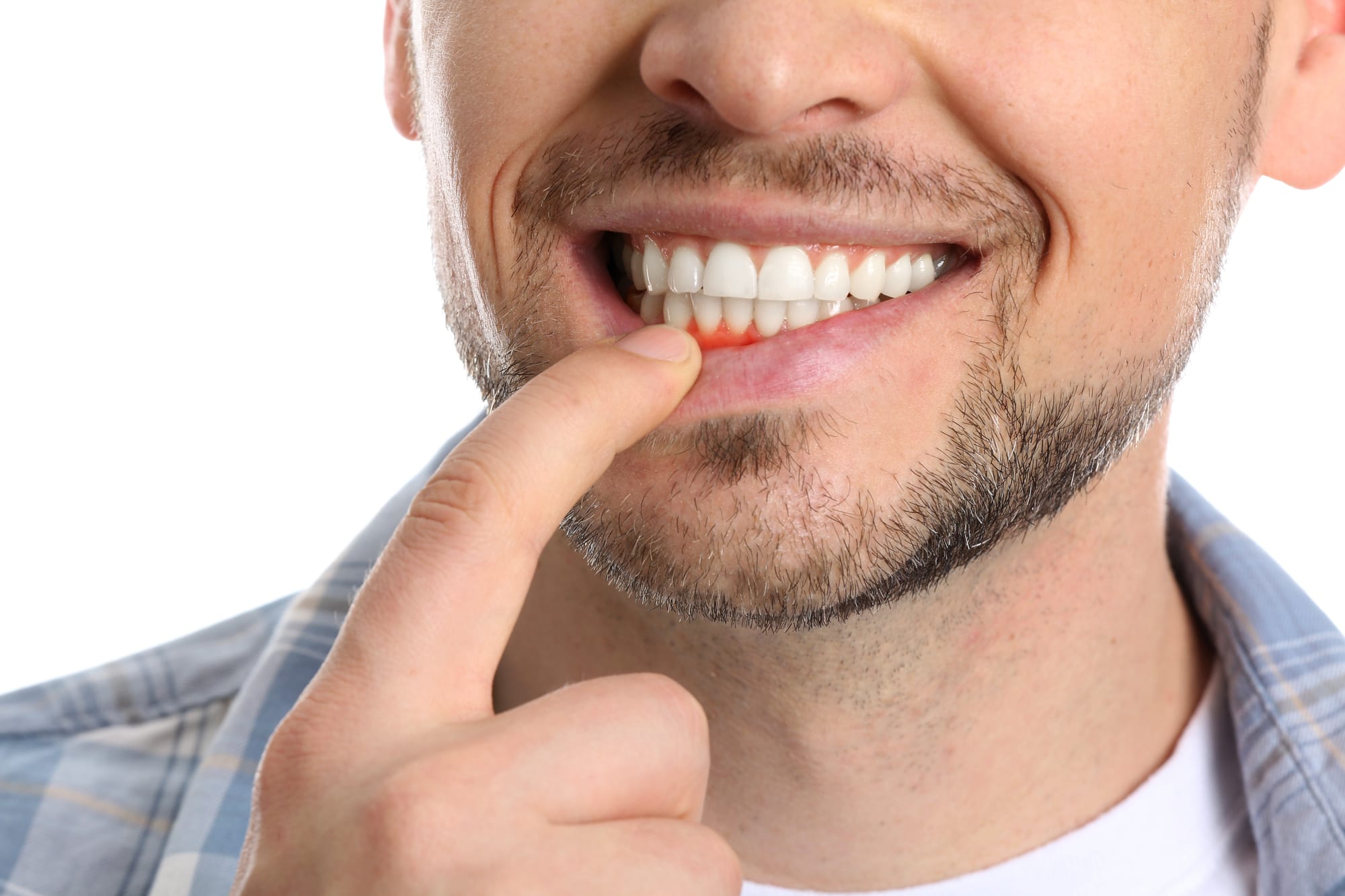 Gum Disease Treatment at Versailles Dental Clinic