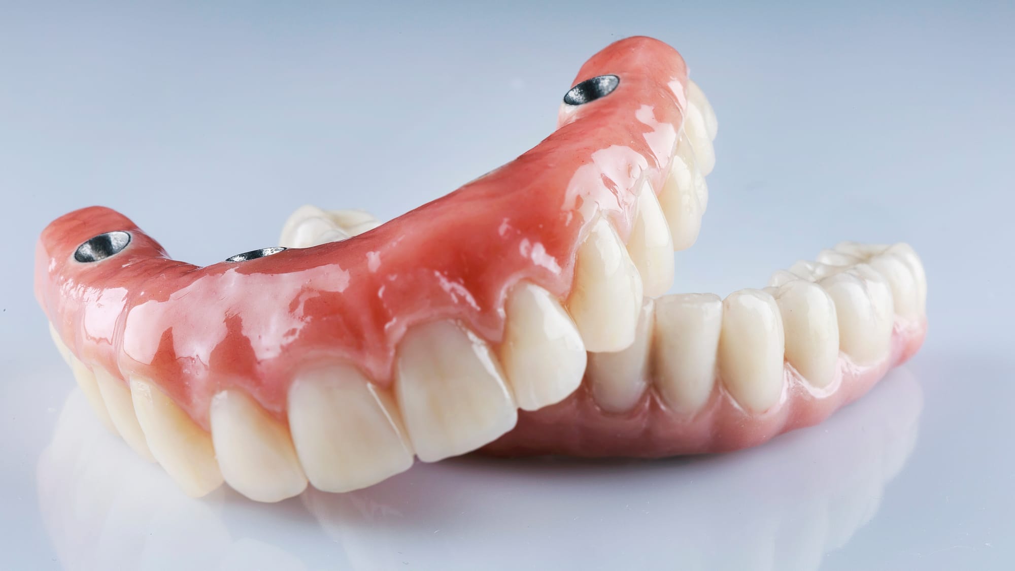 Zirconia Dental Bridges at Versailles Dental Clinic