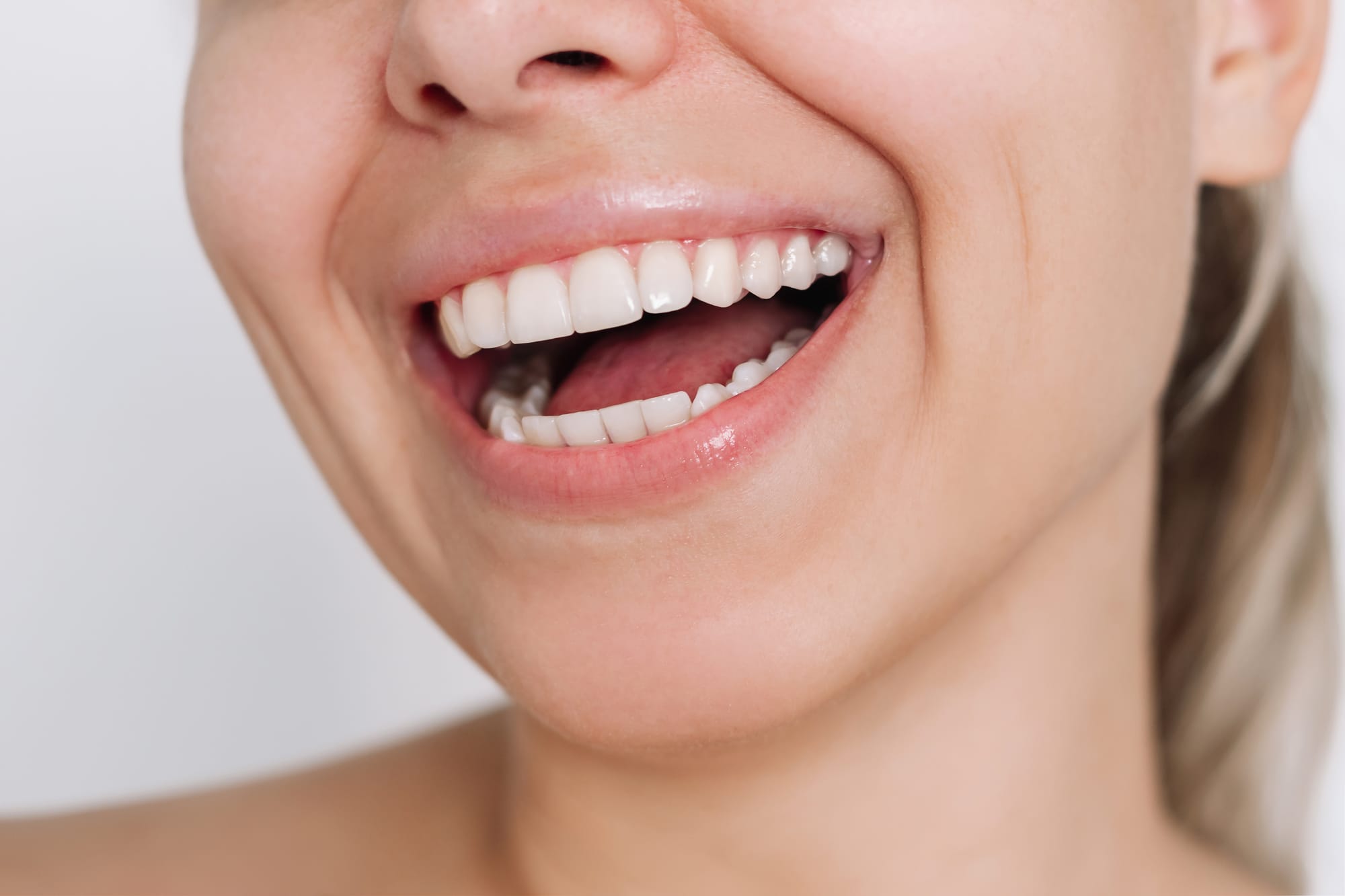 Les Avantages de Choisir un Dentiste Français à Dubaï pour Vos Soins Dentaires