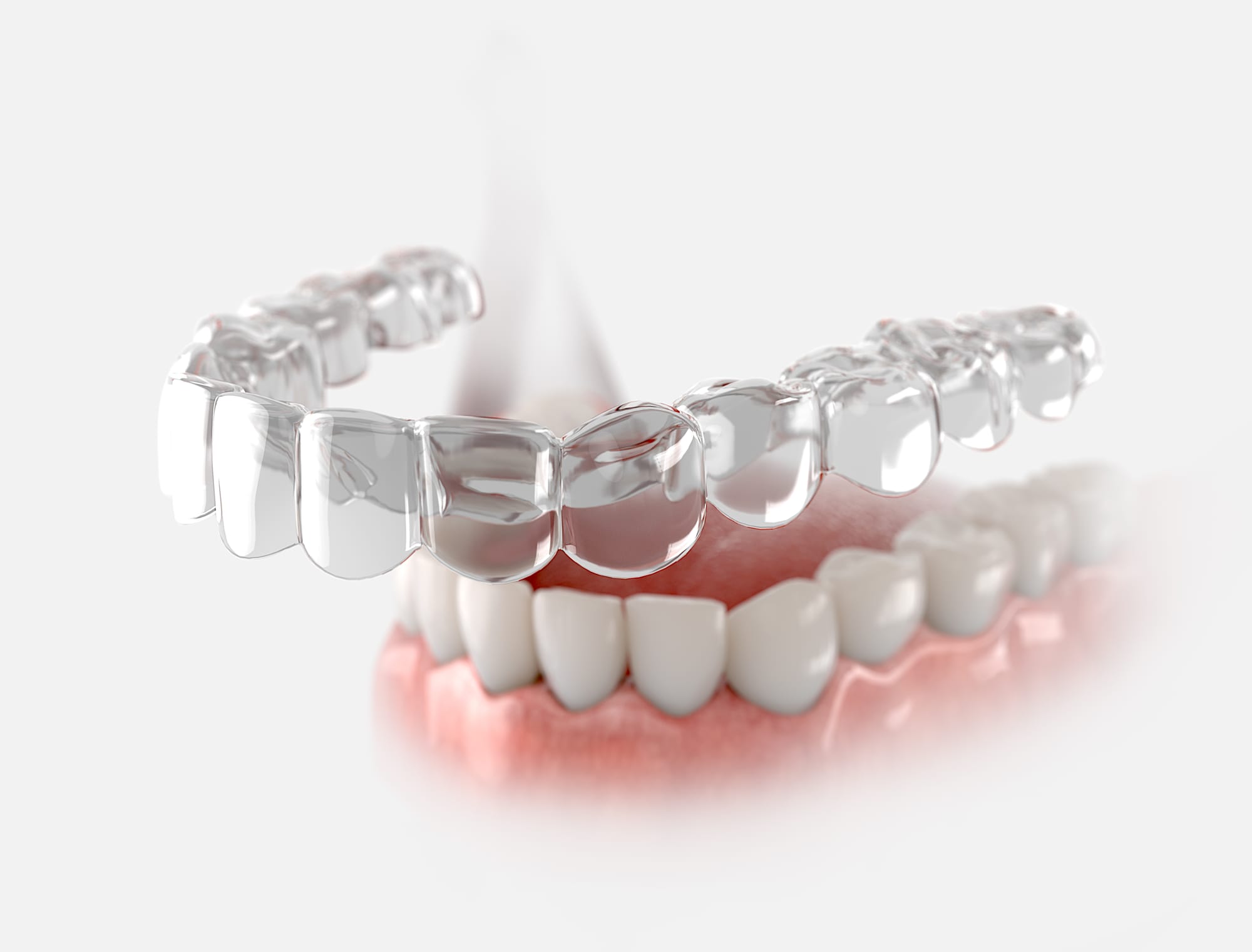 Choosing the Right Dental Clinic in Dubai for Orthodontic Treatment