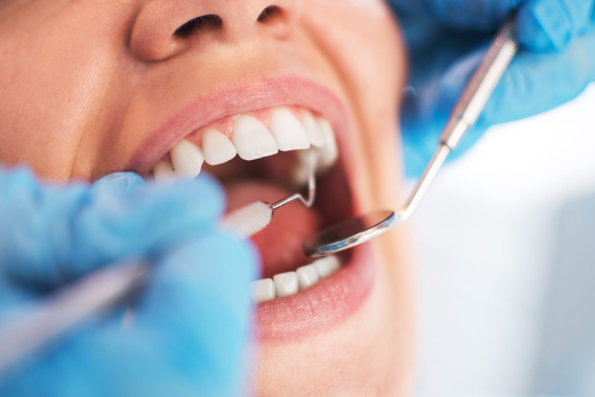 The Before and After of Oral Surgery: A Comprehensive Comparison