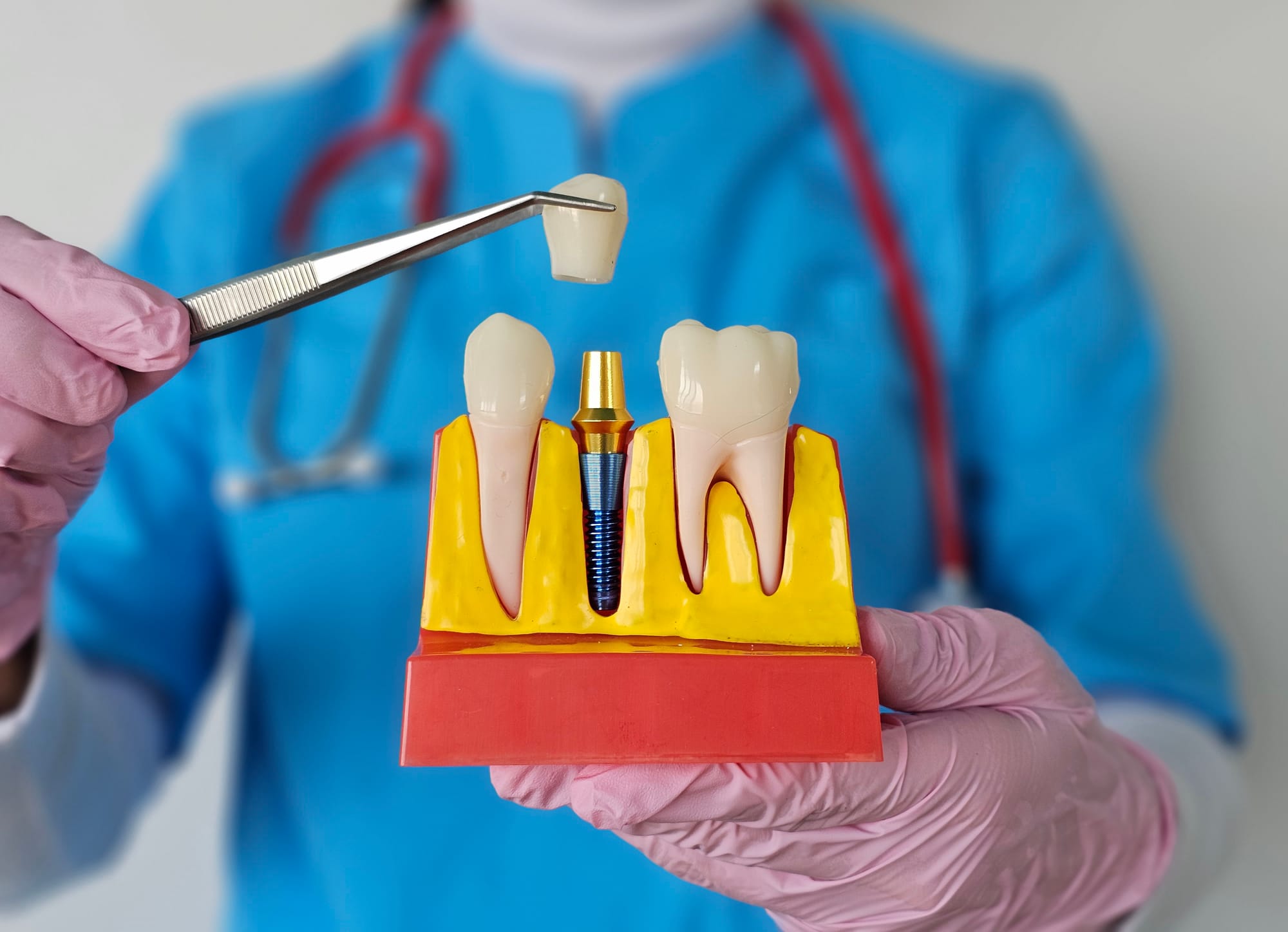 5 Simple Holistic Dental Care Practices for Better Oral Health