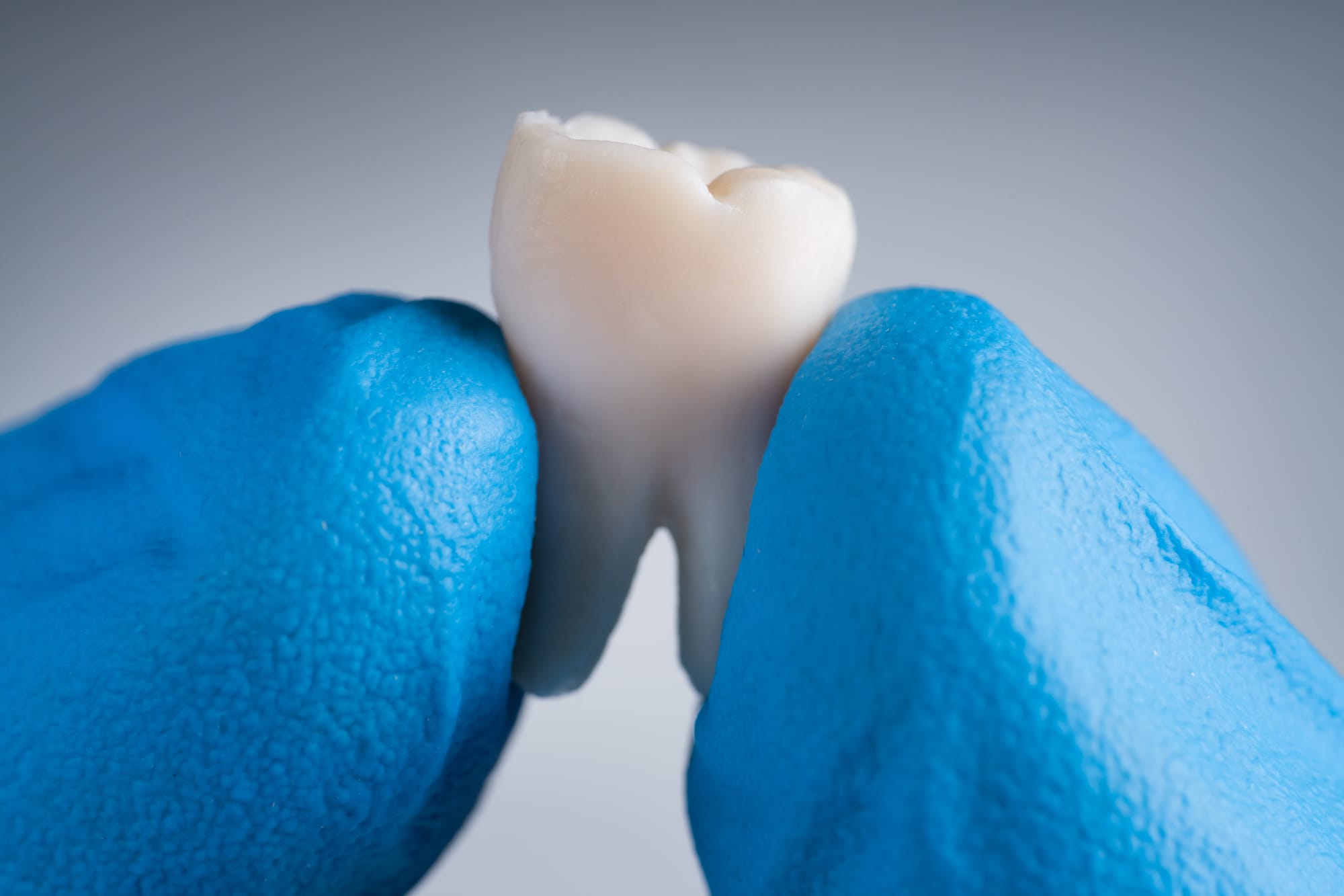 Wisdom Tooth Removal: Understanding Oral Surgery