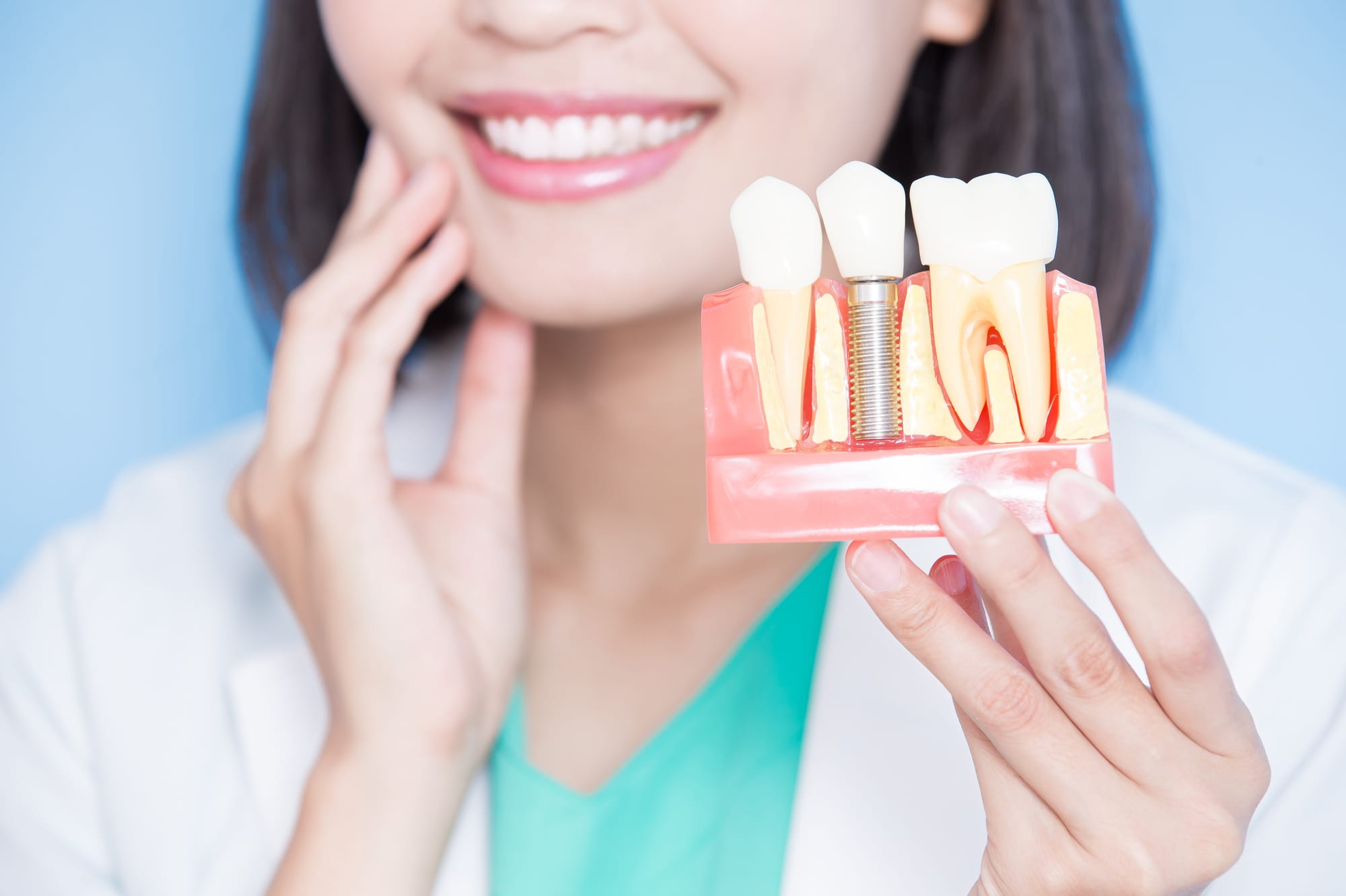 Step-by-Step Guide to the Dental Implant Procedure