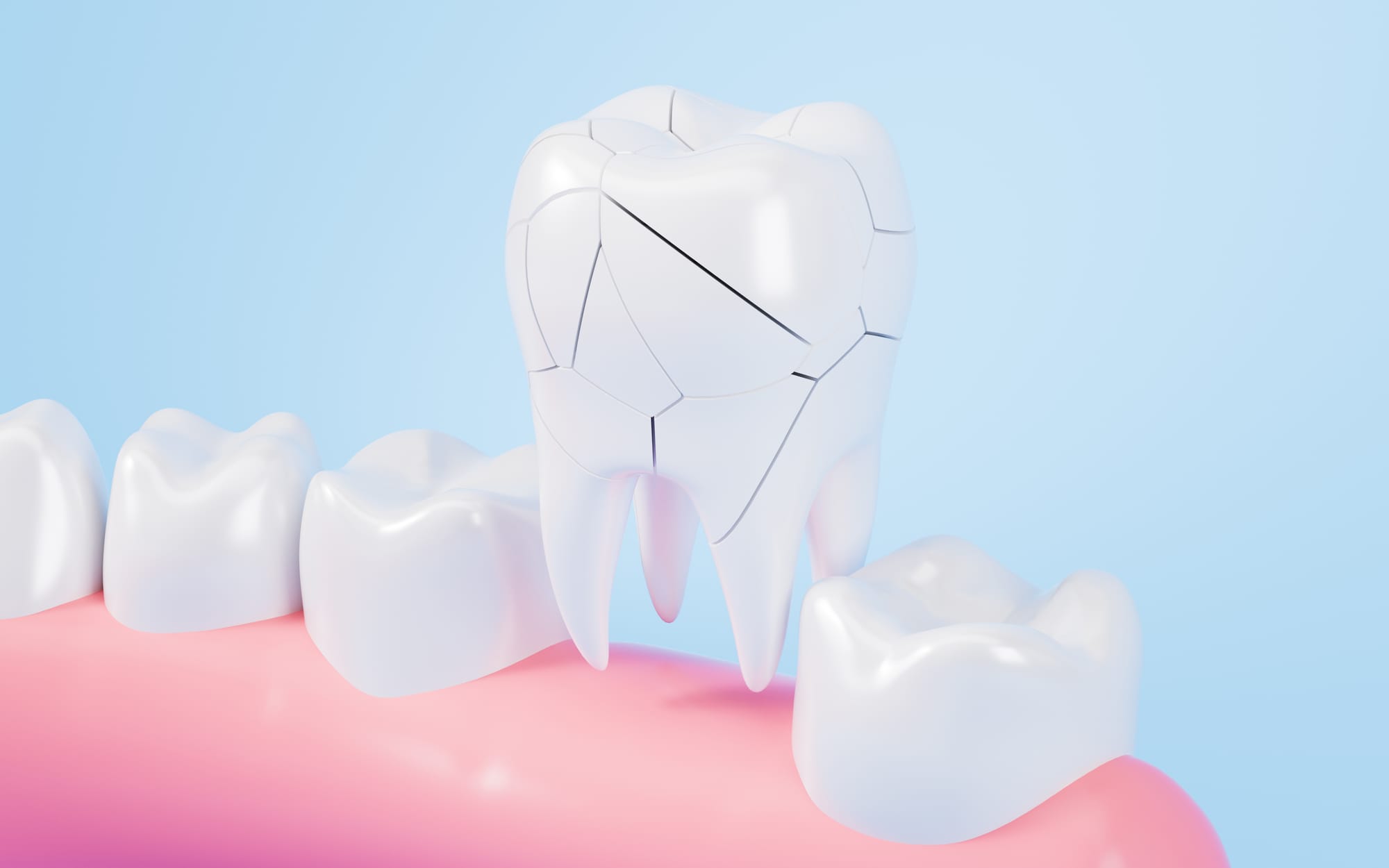 A Complete Guide to Oral Surgery: Procedures, Recovery & Expert Care in Dubai