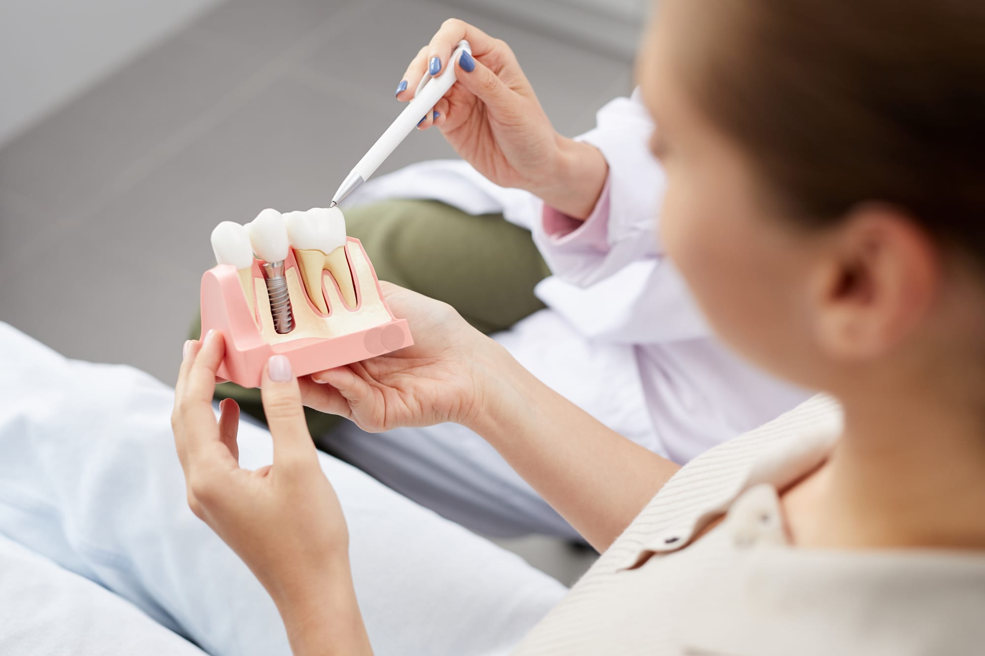 Why Dental Implants Are the Gold Standard for Tooth Replacement