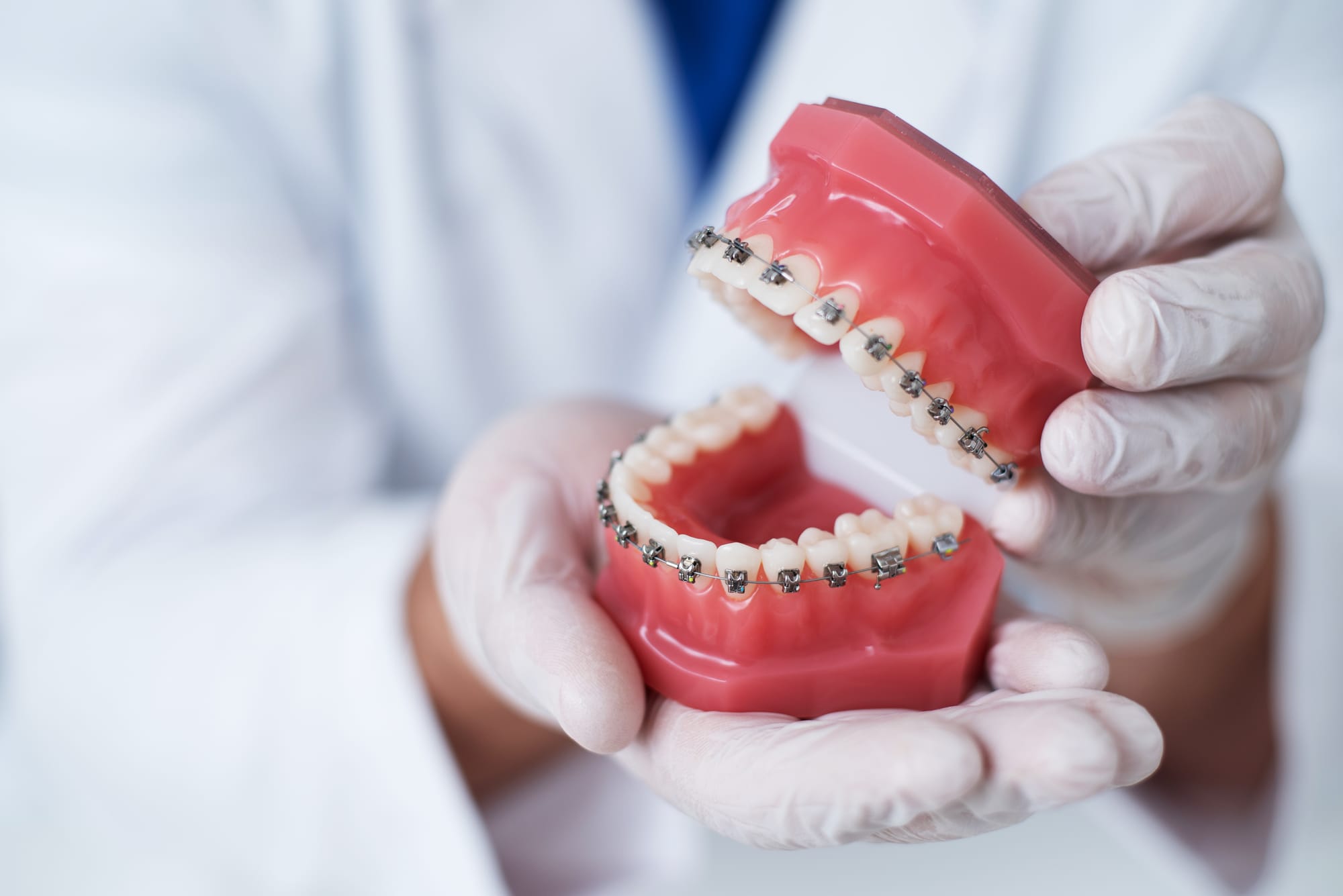Understanding Orthodontics: A Complete Guide for Beginners