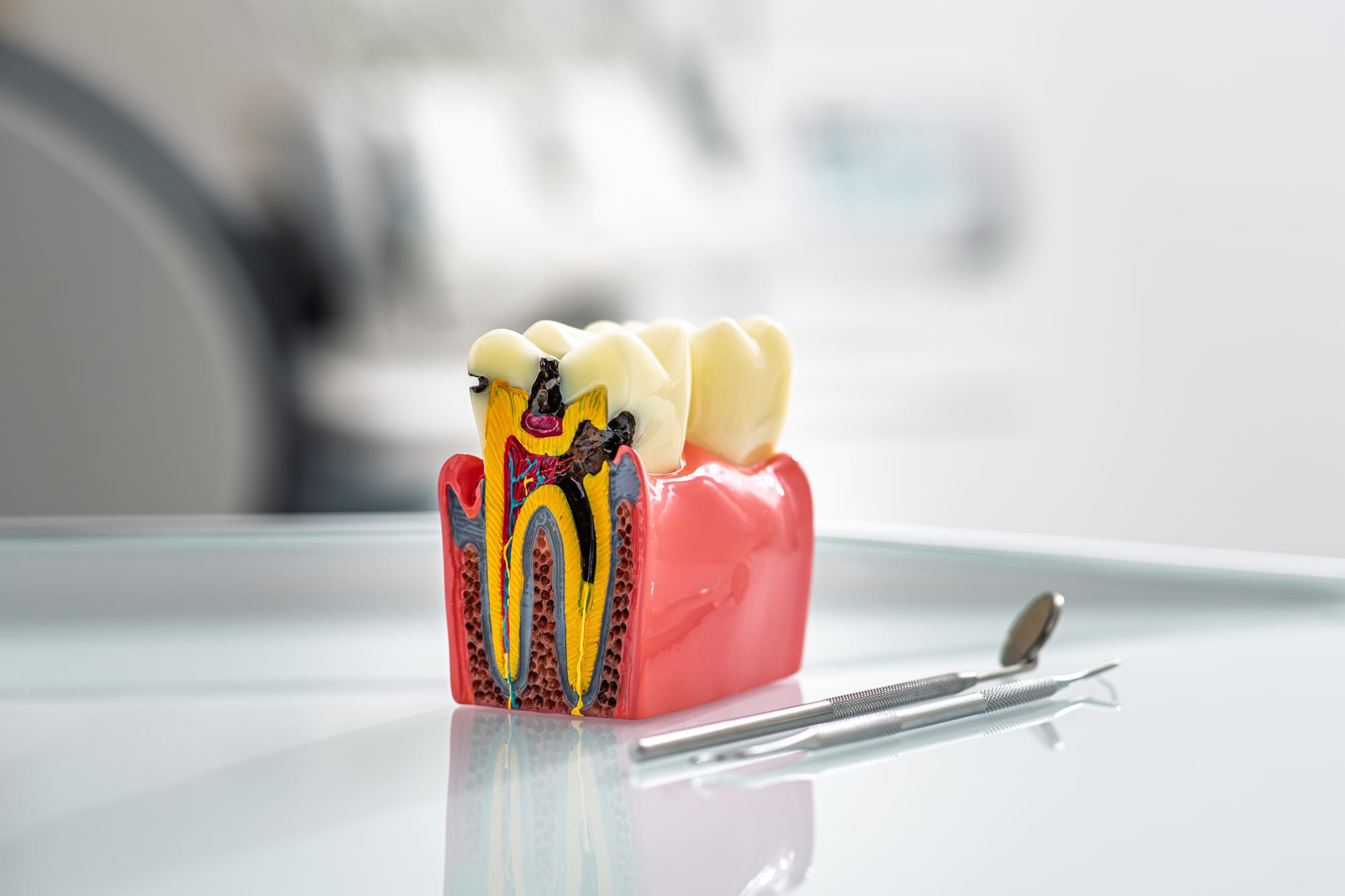 What Is Holistic Dentistry? A Complete Beginner’s Guide