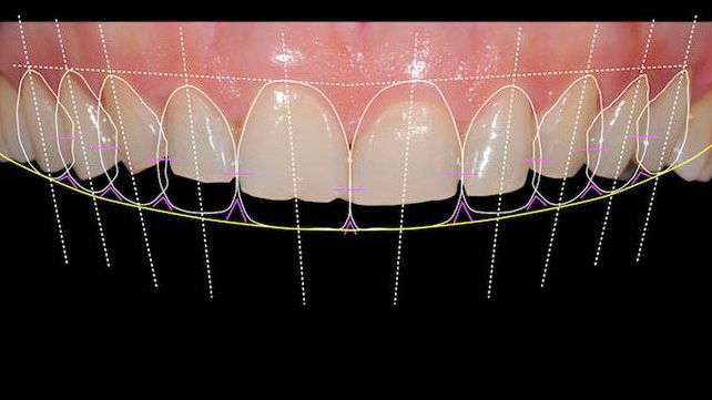 digital smile assessment