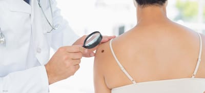 Mole Removal in Dubai: A Confidence Boost