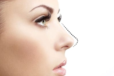 Rhinoplasty Explained: Understanding the Procedure and Its Benefits