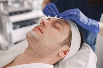 Improved Skin Tone: Chemical Peels for Men