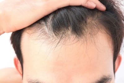 Revolutionary Technologies in Hair Loss Treatment Explained