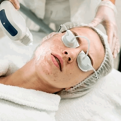 A Cost Breakdown of Popular Acne Laser Treatments
