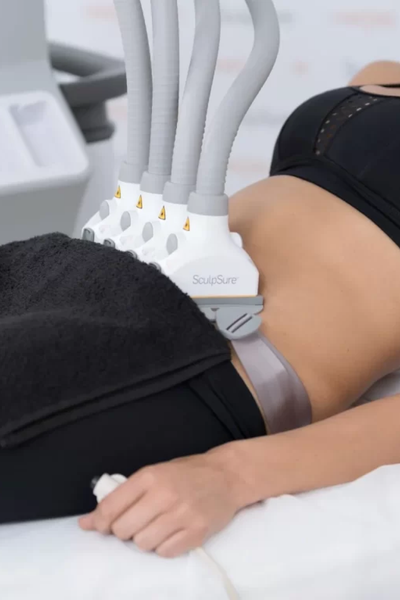 How Effective Is SculpSure Body Contouring?