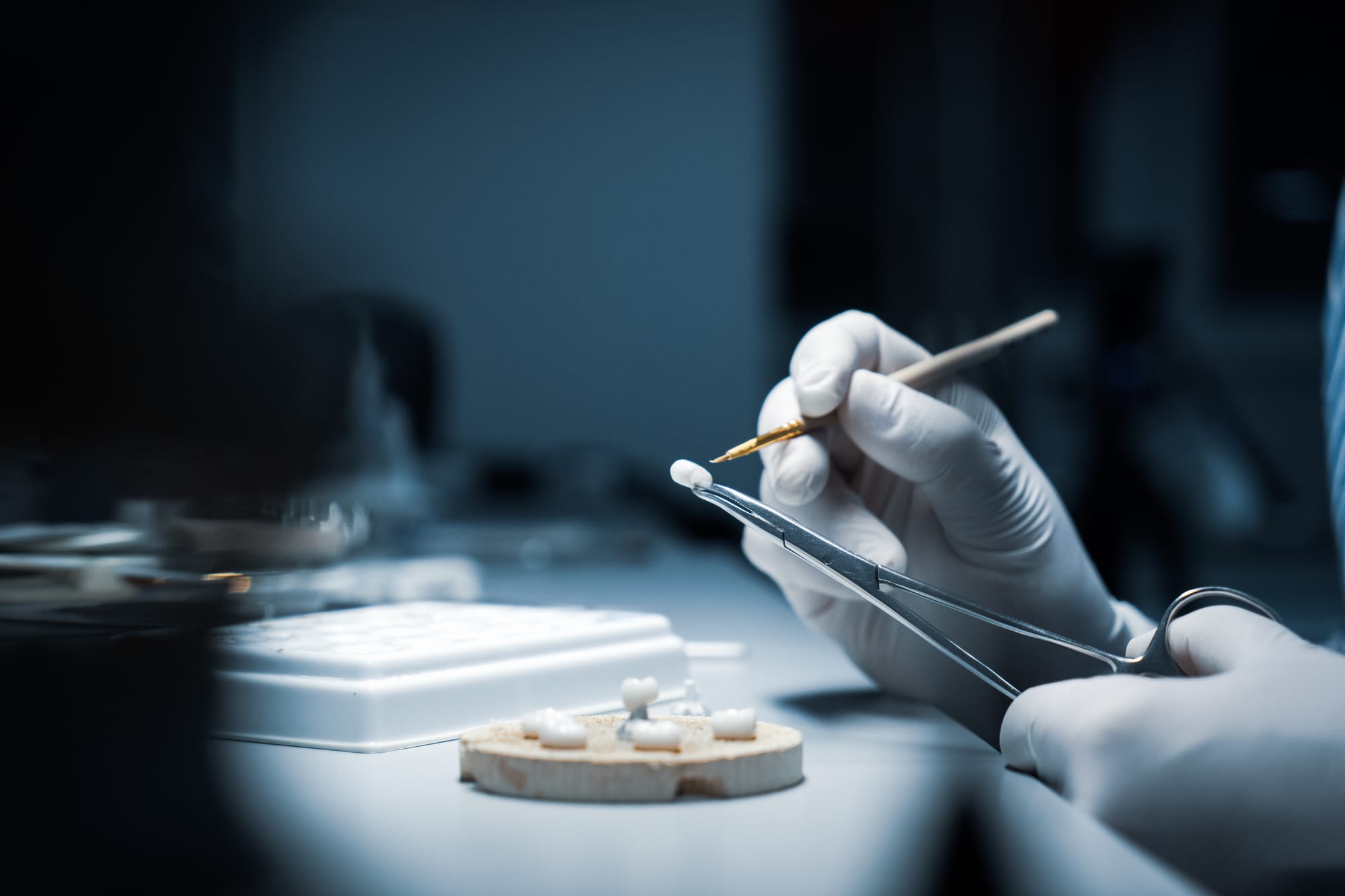 Precision-Crafted Veneers – Art Meets Dentistry