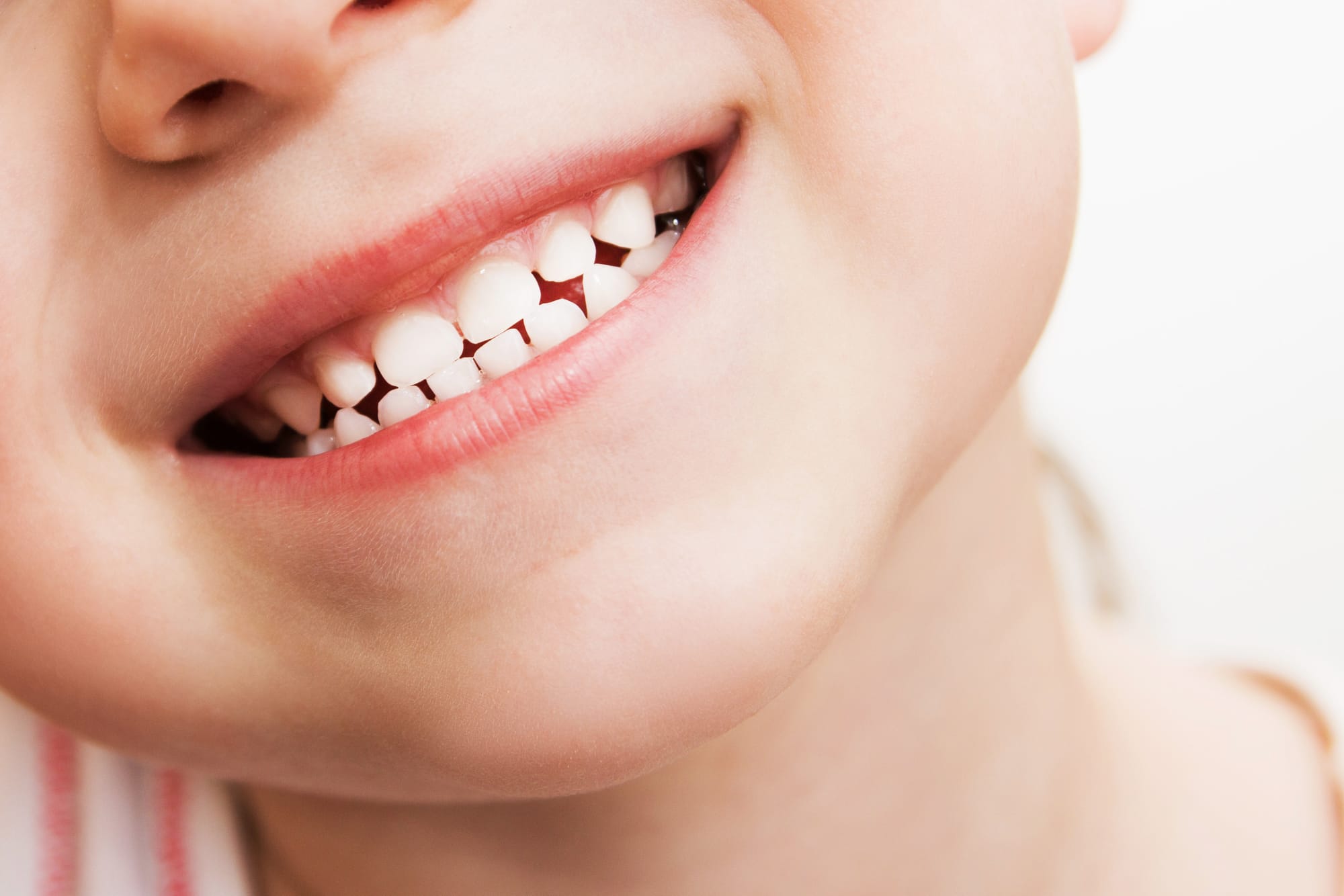 Mixed Dentition Stage – Monitoring Your Child’s Dental Growth