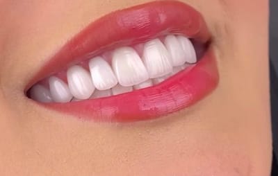 Top 10 Best Dentists Gurgaon