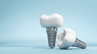 Types Dental Implants