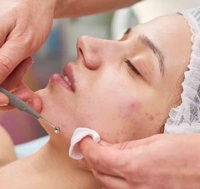 Top Skin Brightening Treatments Recommended Dermatologists