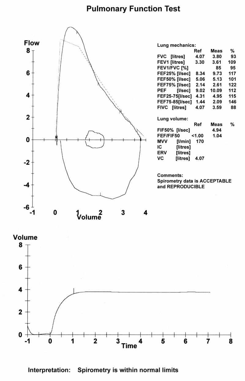 Spirometry Reporting update
