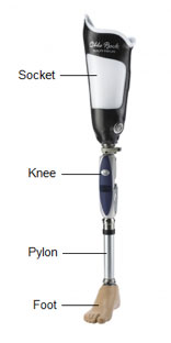 above knee leg prosthetics modifications 1